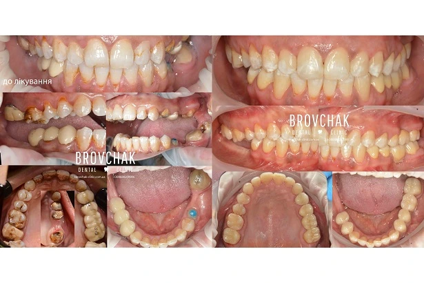 Стоматологія «Brovchak Dental Clinic» (Бровчак Дентал Клінік)