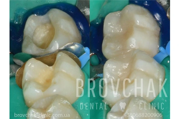 Стоматологія «Brovchak Dental Clinic» (Бровчак Дентал Клінік)