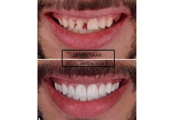 Стоматологія «Dentistman» (Дентістмен на Голосіївській)