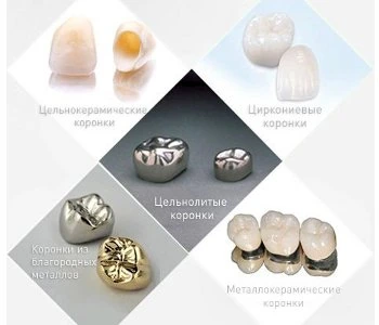 Определение типа коронок