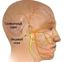 Воспаление лицевого нерва