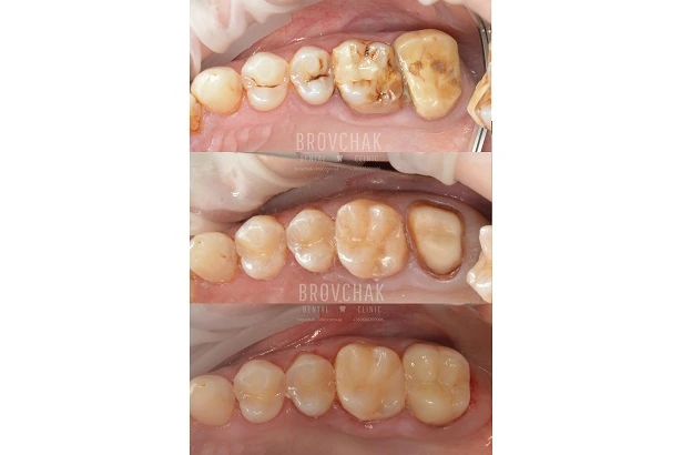 Стоматологія «Brovchak Dental Clinic» (Бровчак Дентал Клінік)