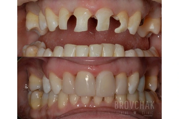Стоматологія «Brovchak Dental Clinic» (Бровчак Дентал Клінік)