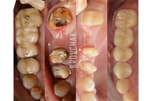 Dentistry «Brovchak Family Dental Care» on Dimeevskaya (Brovchak Family Dental Clinic)