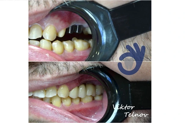 Стоматологія «Good Dental»  (Гудд Дентал)