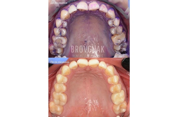 Стоматологія «Brovchak Dental Clinic» (Бровчак Дентал Клінік)