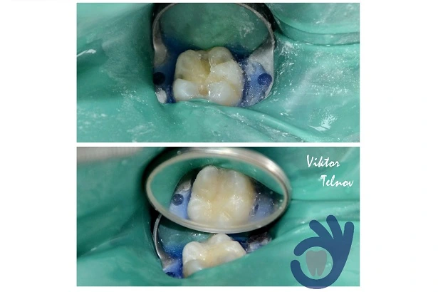 Стоматологія «Good Dental»  (Гудд Дентал)