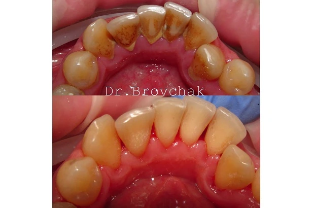 Dentistry «Brovchak Family Dental Care» on Dimeevskaya (Brovchak Family Dental Clinic)