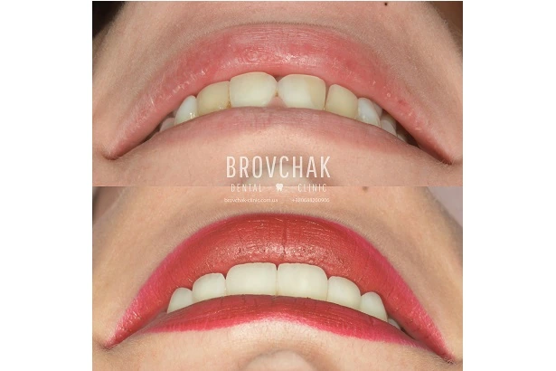Dentistry «Brovchak Family Dental Care» on Dimeevskaya (Brovchak Family Dental Clinic)