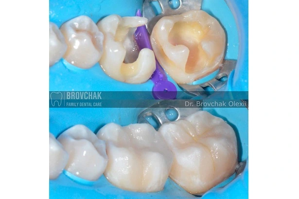 Dentistry «Brovchak Family Dental Care» on Dimeevskaya (Brovchak Family Dental Clinic)