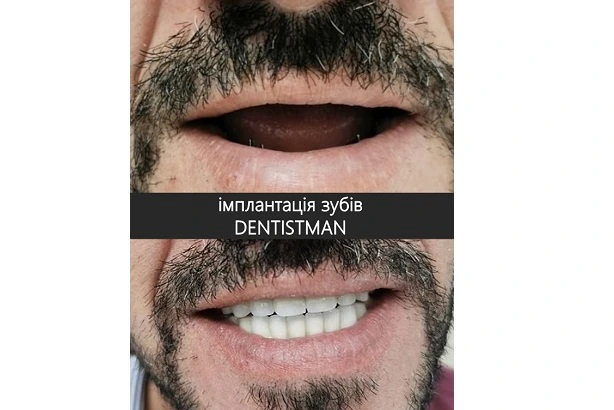 Стоматологія «Dentistman» (Дентістмен на Голосіївській)