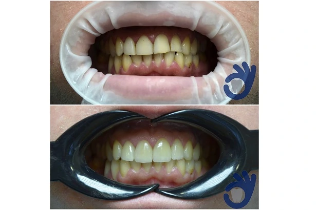Стоматологія «Good Dental»  (Гудд Дентал)