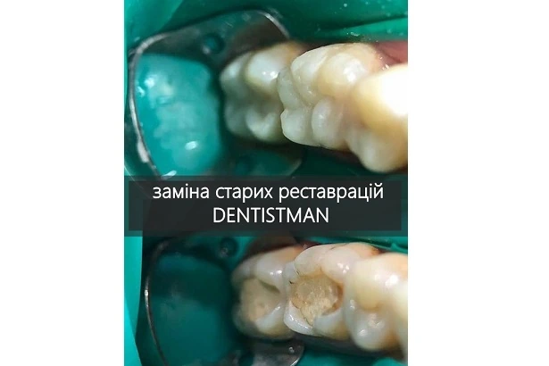 Стоматологія «Dentistman» (Дентістмен на Голосіївській)