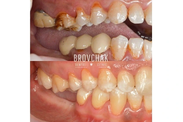 Dentistry «Brovchak Family Dental Care» on Dimeevskaya (Brovchak Family Dental Clinic)