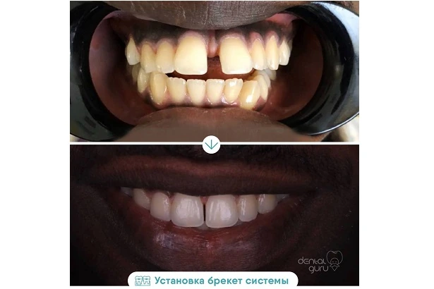 Стоматологія «Dental Guru» (Дентал Гуру)