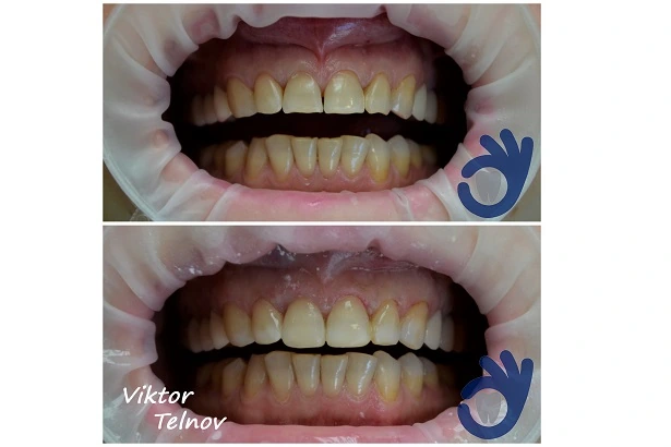Стоматологія «Good Dental»  (Гудд Дентал)