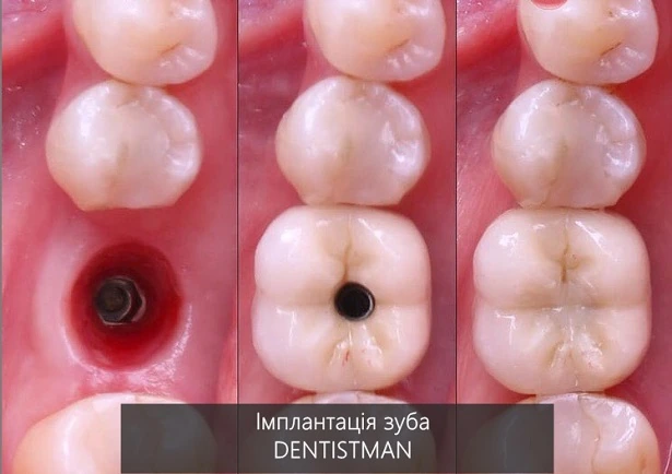 Стоматологія «Dentistman» (Дентістмен на Голосіївській)