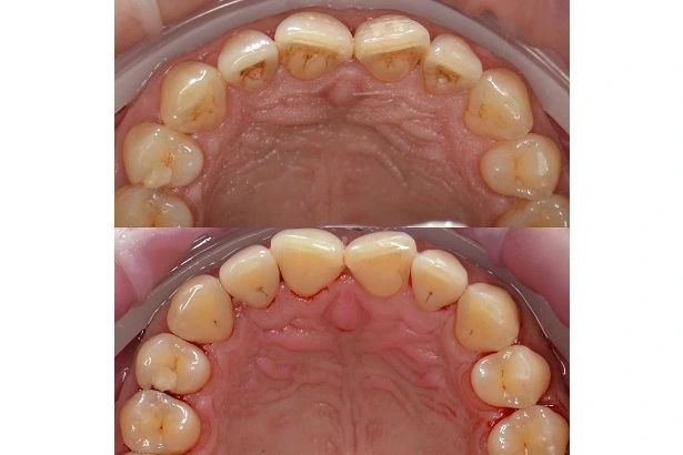 Dentistry «Brovchak Family Dental Care» on Dimeevskaya (Brovchak Family Dental Clinic)