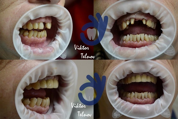 Стоматологія «Good Dental»  (Гудд Дентал)