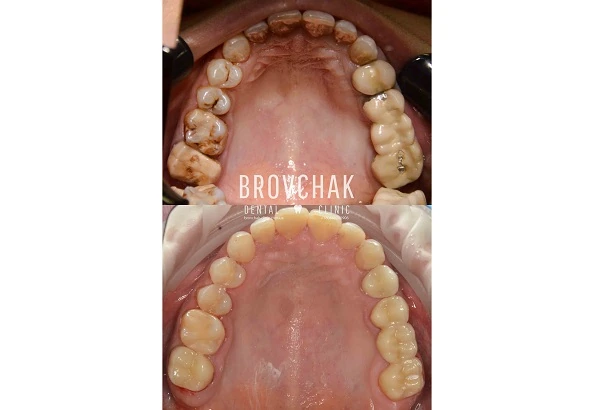 Dentistry «Brovchak Family Dental Care» on Dimeevskaya (Brovchak Family Dental Clinic)