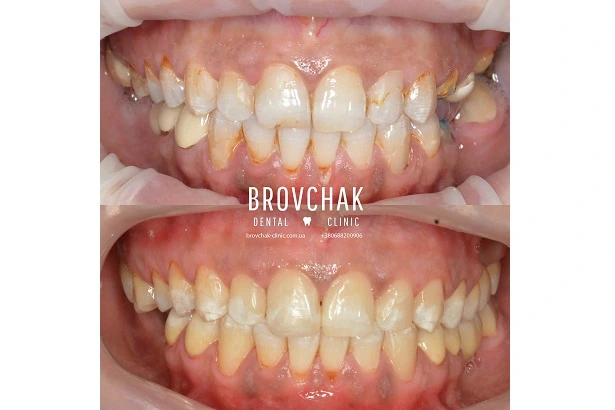 Dentistry «Brovchak Family Dental Care» on Dimeevskaya (Brovchak Family Dental Clinic)