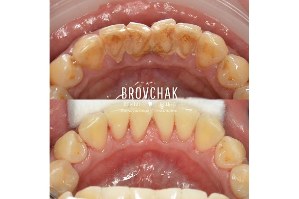 Dentistry «Brovchak Family Dental Care» on Dimeevskaya (Brovchak Family Dental Clinic)