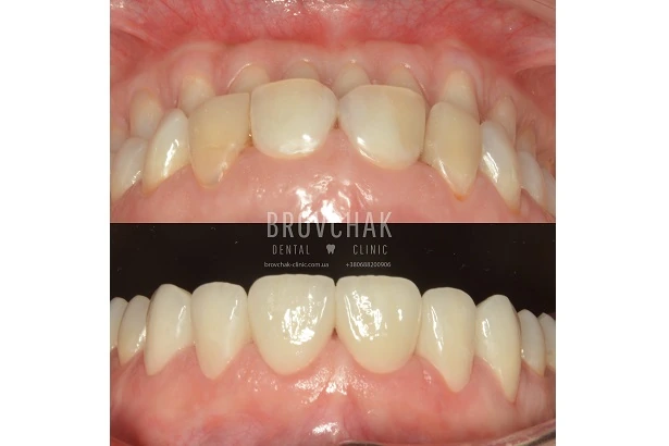 Dentistry «Brovchak Family Dental Care» on Dimeevskaya (Brovchak Family Dental Clinic)