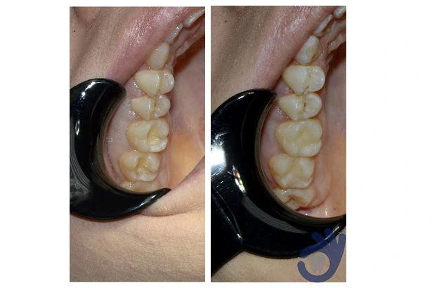 Стоматологія «Good Dental»  (Гудд Дентал)