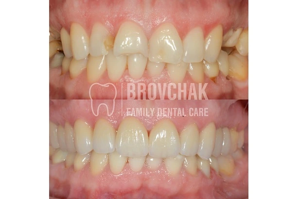 Dentistry «Brovchak Family Dental Care» on Dimeevskaya (Brovchak Family Dental Clinic)