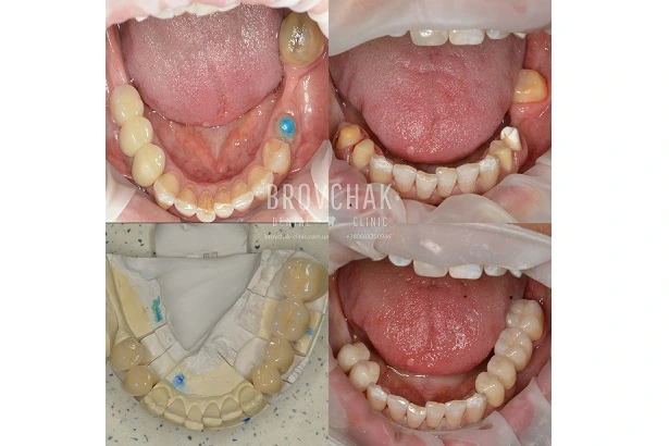 Стоматологія «Brovchak Dental Clinic» (Бровчак Дентал Клінік)