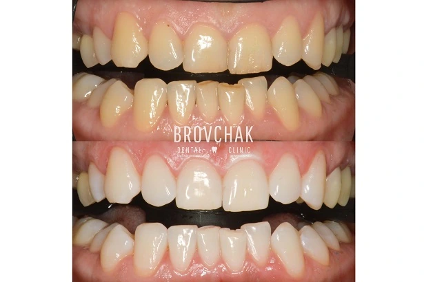 Стоматологія «Brovchak Dental Clinic» (Бровчак Дентал Клінік)