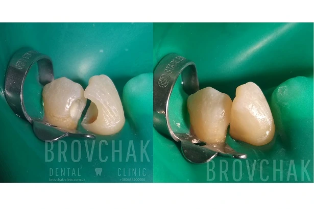 Стоматологія «Brovchak Dental Clinic» (Бровчак Дентал Клінік)