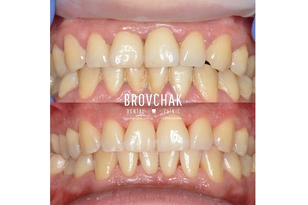 Dentistry «Brovchak Family Dental Care» on Dimeevskaya (Brovchak Family Dental Clinic)