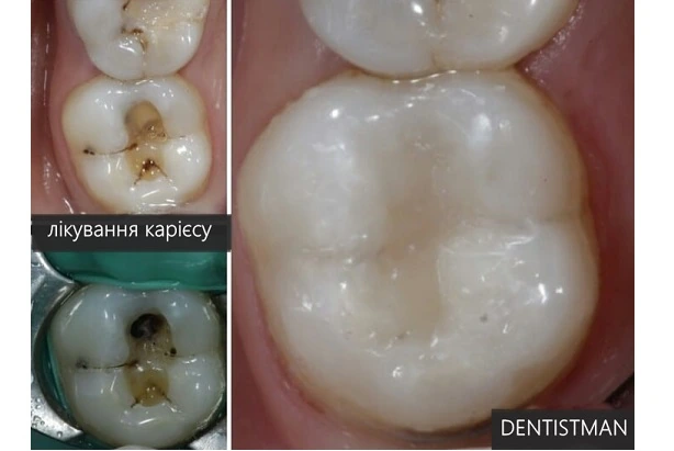 Стоматологія «Dentistman» (Дентістмен на Голосіївській)