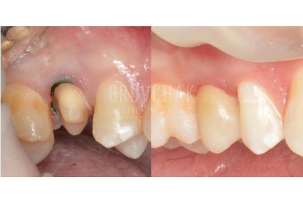 Стоматологія «Brovchak Dental Clinic» (Бровчак Дентал Клінік)