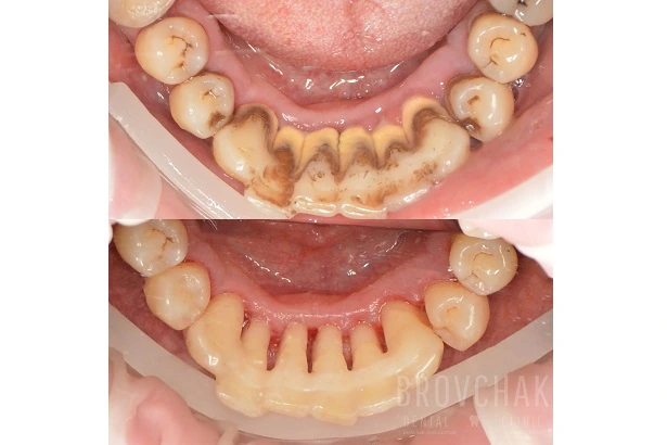 Dentistry «Brovchak Family Dental Care» on Dimeevskaya (Brovchak Family Dental Clinic)