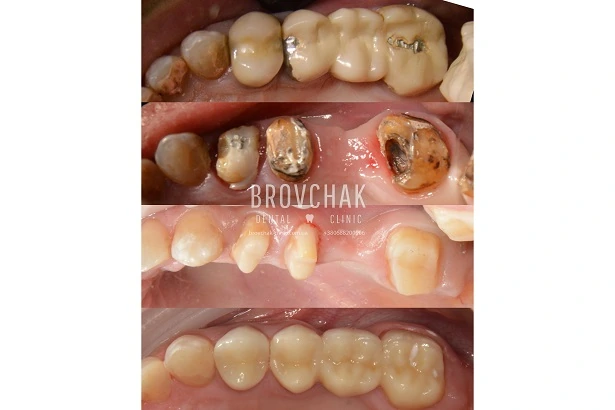 Стоматологія «Brovchak Dental Clinic» (Бровчак Дентал Клінік)