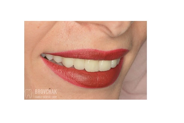 Dentistry «Brovchak Family Dental Care» on Dimeevskaya (Brovchak Family Dental Clinic)