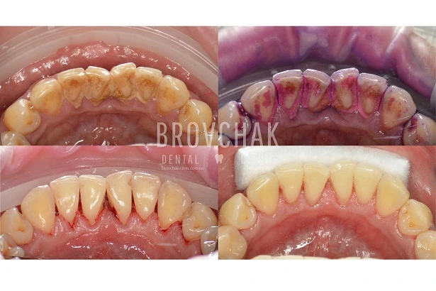 Стоматологія «Brovchak Dental Clinic» (Бровчак Дентал Клінік)