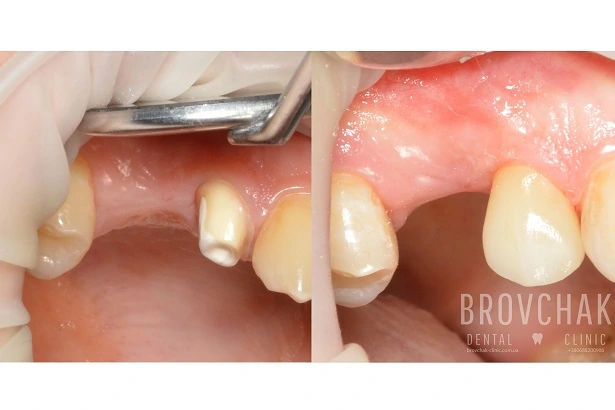 Стоматологія «Brovchak Dental Clinic» (Бровчак Дентал Клінік)