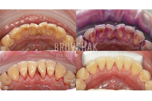 Dentistry «Brovchak Family Dental Care» on Dimeevskaya (Brovchak Family Dental Clinic)