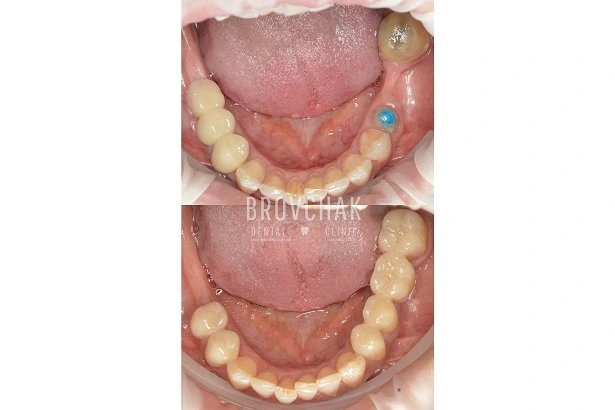 Dentistry «Brovchak Family Dental Care» on Dimeevskaya (Brovchak Family Dental Clinic)