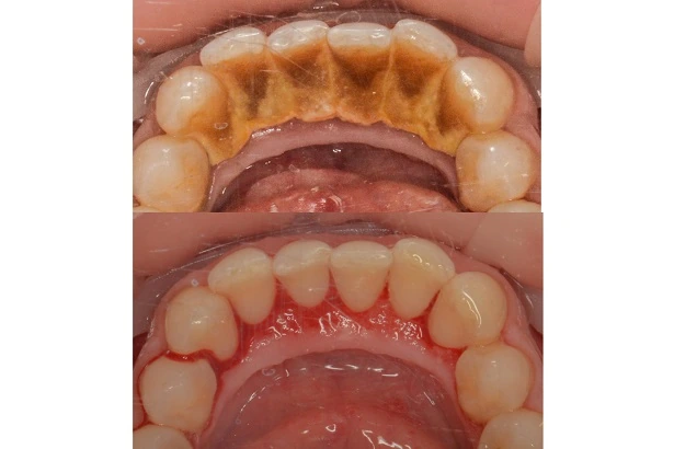 Стоматологія «Brovchak Dental Clinic» (Бровчак Дентал Клінік)