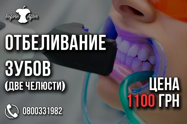 Стоматологія «Before & After»