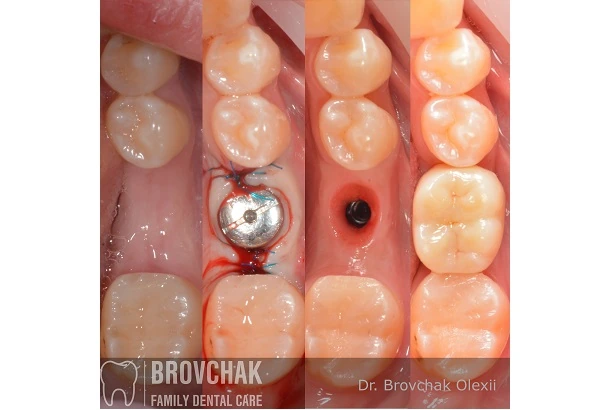 Dentistry «Brovchak Family Dental Care» on Dimeevskaya (Brovchak Family Dental Clinic)
