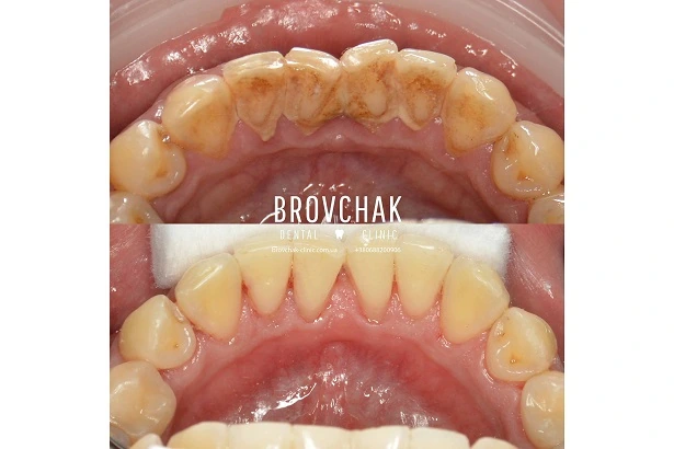 Стоматологія «Brovchak Dental Clinic» (Бровчак Дентал Клінік)