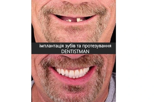 Стоматологія «Dentistman» (Дентістмен на Голосіївській)