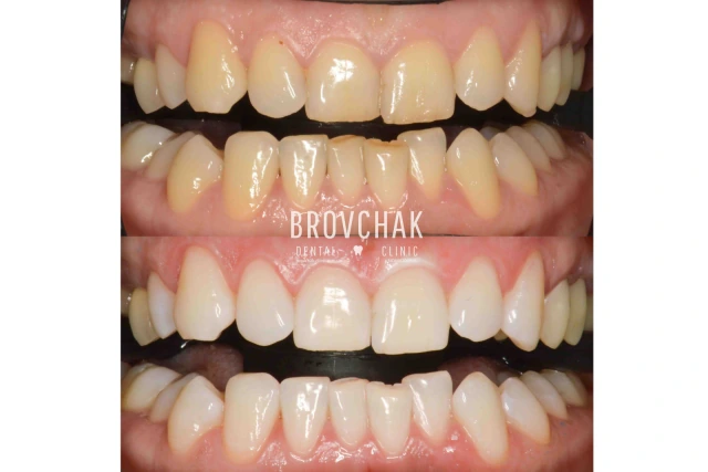 Dentistry «Brovchak Family Dental Care» on Dimeevskaya (Brovchak Family Dental Clinic)