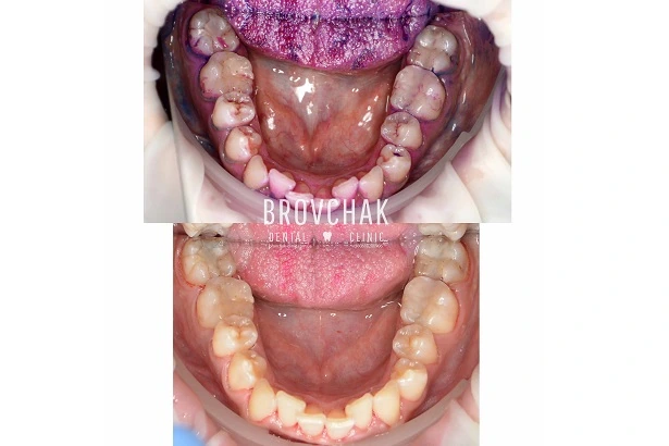 Dentistry «Brovchak Family Dental Care» on Dimeevskaya (Brovchak Family Dental Clinic)