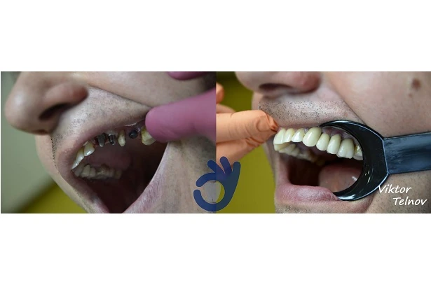 Стоматологія «Good Dental»  (Гудд Дентал)
